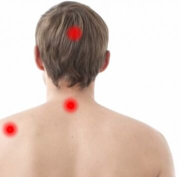 Osteochondrosis focuses